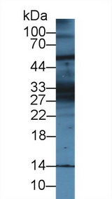 KRT28 / Keratin 28 Antibody - Western Blot; Sample: Mouse Cerebrum lysate; Primary Ab: 1µg/ml Rabbit Anti-Mouse KRT28 Antibody Second Ab: 0.2µg/mL HRP-Linked Caprine Anti-Rabbit IgG Polyclonal Antibody
