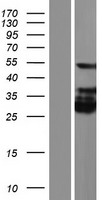 KRT28 / Keratin 28 Protein - Western validation with an anti-DDK antibody * L: Control HEK293 lysate R: Over-expression lysate