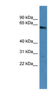 KRT3 / CK3 / Cytokeratin 3 Antibody - KRT3 / Cytokeratin 3 antibody Western blot of Fetal Brain lysate.  This image was taken for the unconjugated form of this product. Other forms have not been tested.