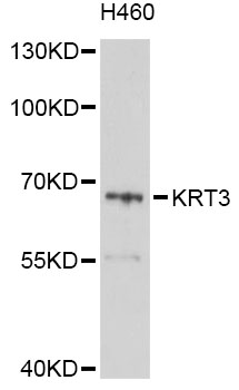 KRT3 / CK3 / Cytokeratin 3 Antibody - Western blot analysis of extracts of H460 cells, using KRT3 antibody at 1:1000 dilution. The secondary antibody used was an HRP Goat Anti-Rabbit IgG (H+L) at 1:10000 dilution. Lysates were loaded 25ug per lane and 3% nonfat dry milk in TBST was used for blocking. An ECL Kit was used for detection and the exposure time was 10s.