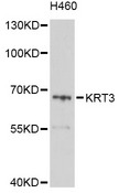 KRT3 / CK3 / Cytokeratin 3 Antibody - Western blot analysis of extracts of H460 cells, using KRT3 antibody at 1:1000 dilution. The secondary antibody used was an HRP Goat Anti-Rabbit IgG (H+L) at 1:10000 dilution. Lysates were loaded 25ug per lane and 3% nonfat dry milk in TBST was used for blocking. An ECL Kit was used for detection and the exposure time was 10s.