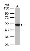KRT31 / Keratin 31 / KRTHA1 Antibody - Sample (30 ug of whole cell lysate). A: Hela. 10% SDS PAGE. KRT31 / HHA1 antibody diluted at 1:1000.