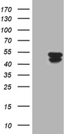 KRT31 / Keratin 31 / KRTHA1 Antibody - HEK293T cells were transfected with the pCMV6-ENTRY control. (Left lane) or pCMV6-ENTRY KRT31. (Right lane) cDNA for 48 hrs and lysed