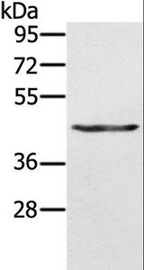 KRT31 / Keratin 31 / KRTHA1 Antibody - Western blot analysis of A549 cell, using KRT31 Polyclonal Antibody at dilution of 1:500.