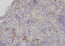 KRT31 / Keratin 31 / KRTHA1 Antibody - 1:100 staining human lymph node tissue by IHC-P. The sample was formaldehyde fixed and a heat mediated antigen retrieval step in citrate buffer was performed. The sample was then blocked and incubated with the antibody for 1.5 hours at 22°C. An HRP conjugated goat anti-rabbit antibody was used as the secondary.