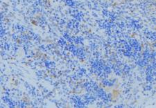 KRT33A / Keratin 33A / KRTHA3A Antibody - 1:100 staining human lymph node tissue by IHC-P. The sample was formaldehyde fixed and a heat mediated antigen retrieval step in citrate buffer was performed. The sample was then blocked and incubated with the antibody for 1.5 hours at 22°C. An HRP conjugated goat anti-rabbit antibody was used as the secondary.