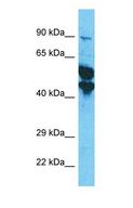 KRT33A / Keratin 33A / KRTHA3A Antibody - Western blot of KRT33A Antibody with human HepG2 Whole Cell lysate.  This image was taken for the unconjugated form of this product. Other forms have not been tested.