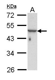 KRT33B / Keratin 33B / KRTHA3B Antibody - Sample (30 ug of whole cell lysate). A: Hela. 10% SDS PAGE. KRT33B antibody diluted at 1:1000.