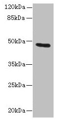 KRT33B / Keratin 33B / KRTHA3B Antibody - Western blot All lanes: KRT33B antibody at 1µg/ml Lane 1: MCF-7 whole cell lysate Lane 2: A549 whole cell lysate Secondary Goat polyclonal to rabbit IgG at 1/10000 dilution Predicted band size: 46 kDa Observed band size: 46 kDa