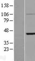 KRT33B / Keratin 33B / KRTHA3B Protein - Western validation with an anti-DDK antibody * L: Control HEK293 lysate R: Over-expression lysate