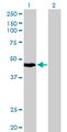 KRT34 / Keratin 34 / KRTHA4 Antibody - Western Blot analysis of KRTHA4 expression in transfected 293T cell line by KRTHA4 monoclonal antibody (M10), clone 3E5.Lane 1: KRTHA4 transfected lysate(49.4 KDa).Lane 2: Non-transfected lysate.