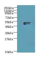 KRT35 / Keratin 35 / KRTHA5 Antibody - Western blot. All lanes: KRT35 antibody at 4 ug/ml3 whole cell lysate Goat polyclonal to rabbit at 1:10000 dilution. Predicted band size: 50 kDa. Observed band size: 50 kDa.