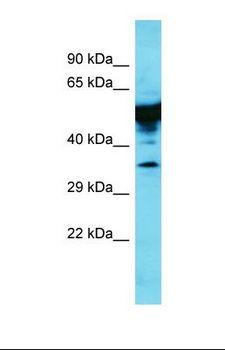 KRT35 / Keratin 35 / KRTHA5 Antibody - Western blot of Rat Lung. Krt35 antibody dilution 1.0 ug/ml.  This image was taken for the unconjugated form of this product. Other forms have not been tested.