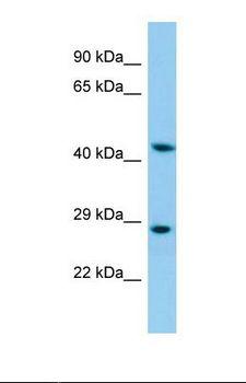 KRT35 / Keratin 35 / KRTHA5 Antibody - Western blot of Human HepG2. KRT35 antibody dilution 1.0 ug/ml.  This image was taken for the unconjugated form of this product. Other forms have not been tested.