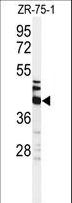 KRT35 / Keratin 35 / KRTHA5 Antibody - Western blot of KRT35 Antibody in ZR-75-1 cell line lysates (35 ug/lane). KRT35 (arrow) was detected using the purified antibody.