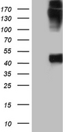KRT35 / Keratin 35 / KRTHA5 Antibody - HEK293T cells were transfected with the pCMV6-ENTRY control. (Left lane) or pCMV6-ENTRY KRT35. (Right lane) cDNA for 48 hrs and lysed. Equivalent amounts of cell lysates. (5 ug per lane) were separated by SDS-PAGE and immunoblotted with anti-KRT35. (1:2000)