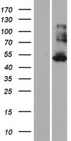 KRT35 / Keratin 35 / KRTHA5 Protein - Western validation with an anti-DDK antibody * L: Control HEK293 lysate R: Over-expression lysate