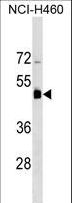 KRT36 / Keratin 36 / KRTHA6 Antibody - KRT36 Antibody western blot of NCI-H460 cell line lysates (35 ug/lane). The KRT36 antibody detected the KRT36 protein (arrow).