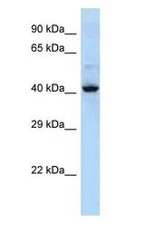 KRT36 / Keratin 36 / KRTHA6 Antibody - KRT36 / Cytokeratin 36 antibody Western Blot of NCI-H226. Antibody dilution: 1 ug/ml.  This image was taken for the unconjugated form of this product. Other forms have not been tested.