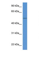 KRT36 / Keratin 36 / KRTHA6 Antibody - KRT36 / Cytokeratin 36 antibody Western blot of Fetal Kidney lysate. Antibody concentration 1 ug/ml.  This image was taken for the unconjugated form of this product. Other forms have not been tested.