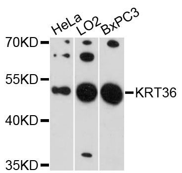 KRT36 / Keratin 36 / KRTHA6 Antibody - Western blot analysis of extracts of various cell lines, using KRT36 antibody at 1:3000 dilution. The secondary antibody used was an HRP Goat Anti-Rabbit IgG (H+L) at 1:10000 dilution. Lysates were loaded 25ug per lane and 3% nonfat dry milk in TBST was used for blocking. An ECL Kit was used for detection and the exposure time was 90s.