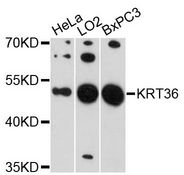 KRT36 / Keratin 36 / KRTHA6 Antibody - Western blot analysis of extracts of various cell lines, using KRT36 antibody at 1:3000 dilution. The secondary antibody used was an HRP Goat Anti-Rabbit IgG (H+L) at 1:10000 dilution. Lysates were loaded 25ug per lane and 3% nonfat dry milk in TBST was used for blocking. An ECL Kit was used for detection and the exposure time was 90s.