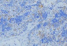 KRT36 / Keratin 36 / KRTHA6 Antibody - 1:100 staining human lymph node tissue by IHC-P. The sample was formaldehyde fixed and a heat mediated antigen retrieval step in citrate buffer was performed. The sample was then blocked and incubated with the antibody for 1.5 hours at 22°C. An HRP conjugated goat anti-rabbit antibody was used as the secondary.