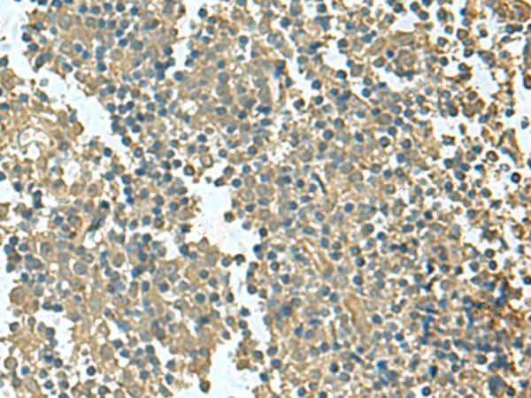 KRT36 / Keratin 36 / KRTHA6 Antibody - Immunohistochemistry of paraffin-embedded Human tonsil tissue  using KRT36 Polyclonal Antibody at dilution of 1:50(×200)