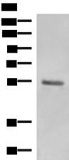 KRT36 / Keratin 36 / KRTHA6 Antibody - Western blot analysis of Human skin tissue lysate  using KRT36 Polyclonal Antibody at dilution of 1:1000