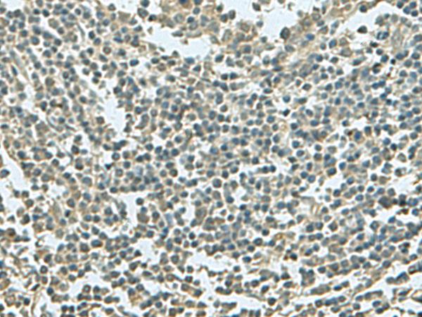 KRT36 / Keratin 36 / KRTHA6 Antibody - Immunohistochemistry of paraffin-embedded Human tonsil tissue  using KRT36 Polyclonal Antibody at dilution of 1:55(×200)