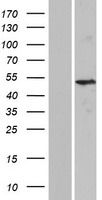 KRT37 / Keratin 37 / KRTHA7 Protein - Western validation with an anti-DDK antibody * L: Control HEK293 lysate R: Over-expression lysate