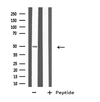 KRT37 + KRT38 Antibody - Western blot analysis of extracts of LOVO cells using KRT37/38 antibody.