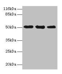 KRT38 / Keratin 38 / KRTHA8 Antibody - Western blot All lanes: Keratin, type I cuticular Ha8 antibody at 2µg/ml Lane 1: MCF-7 whole cell lysate Lane 2: Hela whole cell lysate Lane 3: HepG2 whole cell lysate Secondary Goat polyclonal to rabbit IgG at 1/10000 dilution Predicted band size: 50 kDa Observed band size: 50 kDa