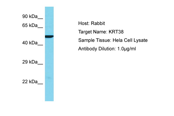 KRT38 / Keratin 38 / KRTHA8 Antibody -  This image was taken for the unconjugated form of this product. Other forms have not been tested.