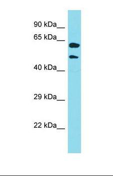 KRT39 / Cytokeratin 39 Antibody - Western blot of Human RPMI-8226. KRT39 antibody dilution 1.0 ug/ml.  This image was taken for the unconjugated form of this product. Other forms have not been tested.