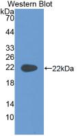 KRT4 / CK4 / Cytokeratin 4 Antibody