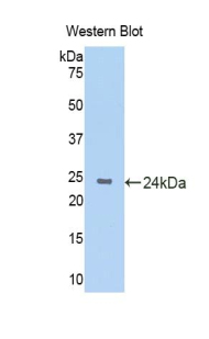 KRT4 / CK4 / Cytokeratin 4 Antibody - Western blot of recombinant KRT4 / CK4 / Cytokeratin 4.  This image was taken for the unconjugated form of this product. Other forms have not been tested.