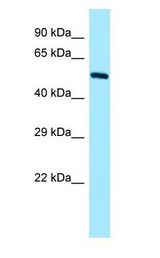 KRT4 / CK4 / Cytokeratin 4 Antibody - KRT4 / CK4 / Cytokeratin 4 antibody Western Blot of Jurkat.  This image was taken for the unconjugated form of this product. Other forms have not been tested.