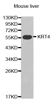 KRT4 / CK4 / Cytokeratin 4 Antibody - Western blot analysis of extracts of mouse liver cell line, using KRT4 antibody.