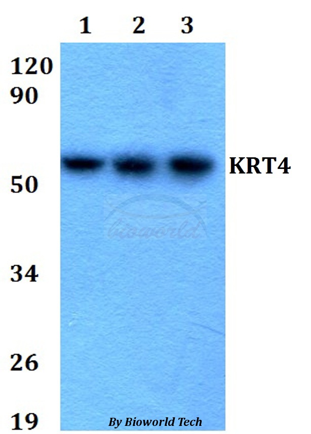 KRT4 / CK4 / Cytokeratin 4 Antibody - Western blot of KRT4 antibody at 1:500 dilution. Lane 1: HEK293T whole cell lysate. Lane 2: Raw264.7 whole cell lysate. Lane 3: PC12 whole cell lysate.