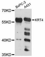 KRT4 / CK4 / Cytokeratin 4 Antibody - Western blot analysis of extracts of various cell lines, using KRT4 antibody at 1:3000 dilution. The secondary antibody used was an HRP Goat Anti-Rabbit IgG (H+L) at 1:10000 dilution. Lysates were loaded 25ug per lane and 3% nonfat dry milk in TBST was used for blocking. An ECL Kit was used for detection and the exposure time was 15s.