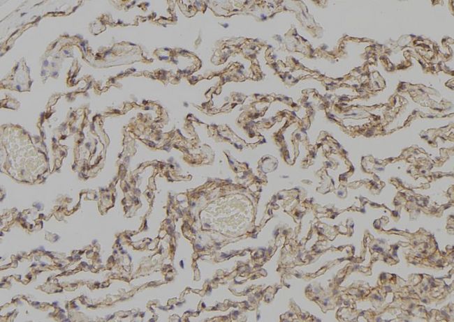 KRT4 / CK4 / Cytokeratin 4 Antibody - 1:100 staining human lung tissue by IHC-P. The sample was formaldehyde fixed and a heat mediated antigen retrieval step in citrate buffer was performed. The sample was then blocked and incubated with the antibody for 1.5 hours at 22°C. An HRP conjugated goat anti-rabbit antibody was used as the secondary.