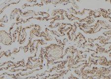 KRT4 / CK4 / Cytokeratin 4 Antibody - 1:100 staining human lung tissue by IHC-P. The sample was formaldehyde fixed and a heat mediated antigen retrieval step in citrate buffer was performed. The sample was then blocked and incubated with the antibody for 1.5 hours at 22°C. An HRP conjugated goat anti-rabbit antibody was used as the secondary.