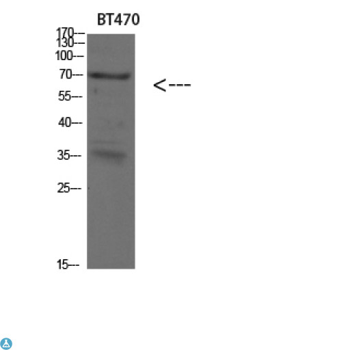 KRT4 / CK4 / Cytokeratin 4 Antibody - Western blot analysis of BT470 lysate, antibody was diluted at 500. Secondary antibody was diluted at 1:20000.