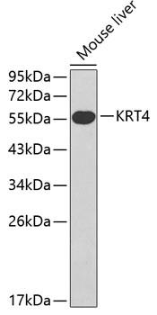 KRT4 / CK4 / Cytokeratin 4 Antibody - Western blot analysis of extracts of mouse liver using KRT4 Polyclonal Antibody.