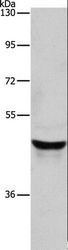 KRT40 / Hair Keratin KA36 Antibody - Western blot analysis of Lovo cell, using KRT40 Polyclonal Antibody at dilution of 1:950.