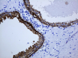 KRT5 / CK5 / Cytokeratin 5 Antibody - IHC of paraffin-embedded Human prostate tissue using anti-KRT5 mouse monoclonal antibody.