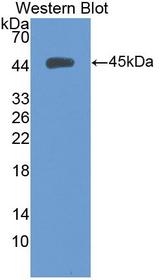 KRT5 / CK5 / Cytokeratin 5 Antibody - Western Blot; Sample: Recombinant protein.