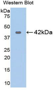 KRT5 / CK5 / Cytokeratin 5 Antibody - Western blot of recombinant KRT5 / CK5 / Cytokeratin 5.  This image was taken for the unconjugated form of this product. Other forms have not been tested.