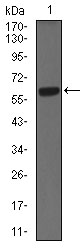 KRT5 / CK5 / Cytokeratin 5 Antibody - Western blot using CK5 mouse monoclonal antibody against A431 (1) cell lysate.